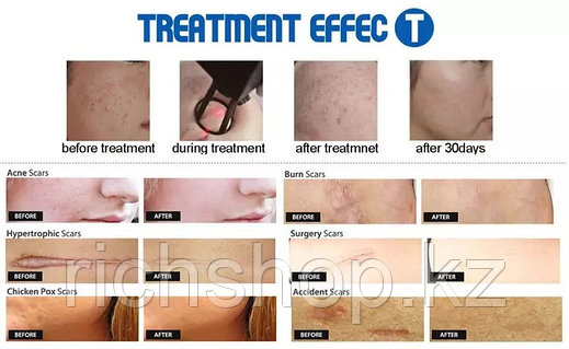 Порно берілген