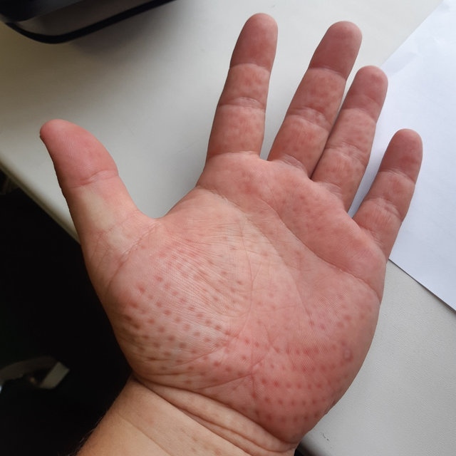 колготкидегі бөкселер