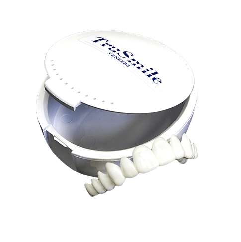 Виниры Trusmile Veneers