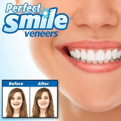 Виниры съемные Perfect Smile Veneers [накладные зубы] - фото 1 - id-p69747108