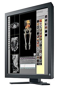 Медицинский монитор Eizo RadiForce RX250 21 '', фото 2
