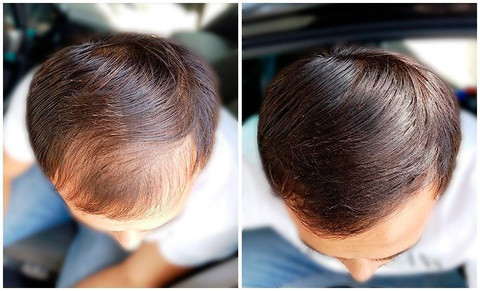 Загуститель волос камуфлирующий Lutino Hair Building Fibers (Черный) - фото 9 - id-p70973267