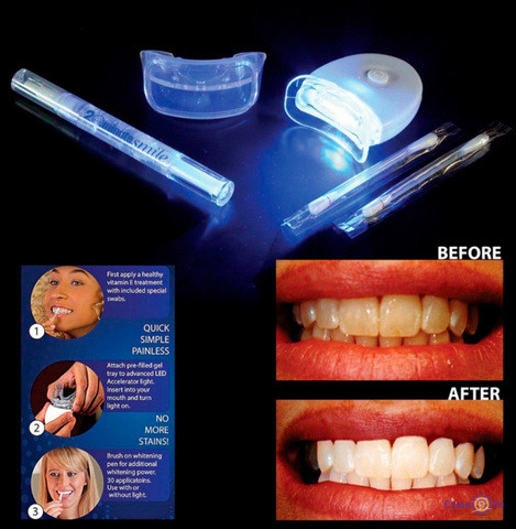 Система для отбеливания зубов 20 MINUTE Dental White - фото 5 - id-p70992995