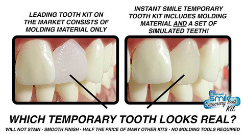 Набор временных зубов-виниров Smile Temporary Tooth Kit - фото 3 - id-p70991725