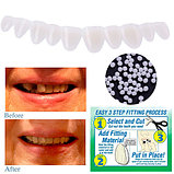 Набор временных зубов-виниров Smile Temporary Tooth Kit, фото 5
