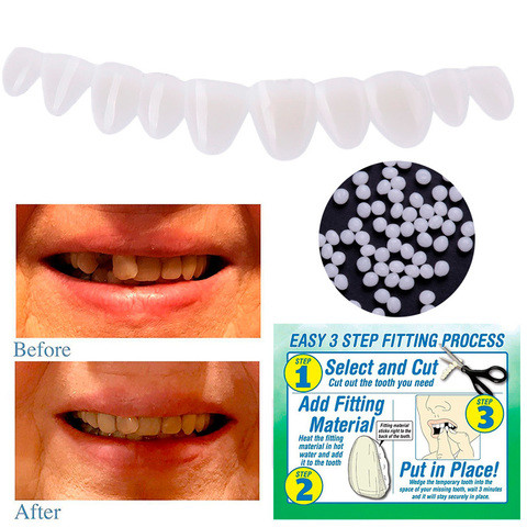 Набор временных зубов-виниров Smile Temporary Tooth Kit - фото 5 - id-p70991725