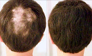 Загуститель волос камуфлирующий Lutino Hair Building Fibers (Черный), фото 8