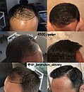 Восстановление волос, фото 2