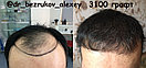 Восстановление волос, фото 9