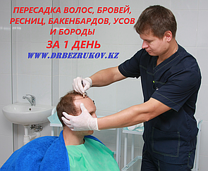 Пересадка волос методом фолликулярной экстракции в Алматы