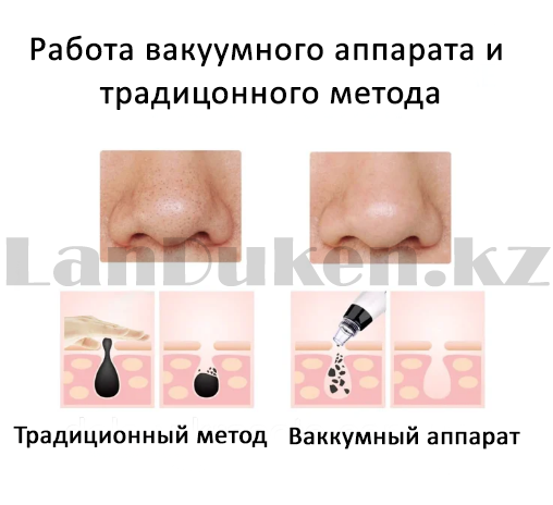 работа аппарата rabota apparata