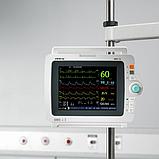 Прикроватный монитор пациента MINDRAY iMEC 8, фото 2