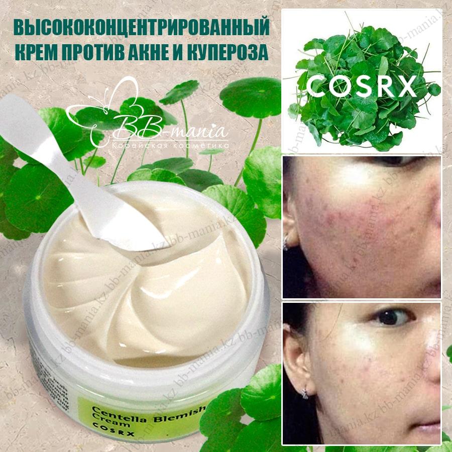 Centella blemish cream