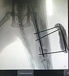 Цифровой рентген, фото 3