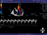 Кардиологический скрининг (консультация кардиолога, ЭХО КГ, рентгенография грудной клетк, фото 2