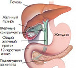 Желчнокаменная болезнь. Комплекс, 3-х месячный курс.