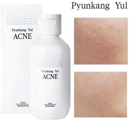 Тонер для проблемной кожи Pyunkang Yul Acne toner, 150 мл, фото 2