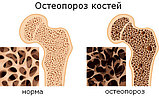 Анти-остеопороз Форте - капли от остеопороза, фото 2