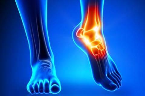 FlexiOn капсулы для лечения боли в суставах