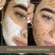 УХОД ЗА ПРОБЛЕМНОЙ КОЖЕЙ ЛИЦА