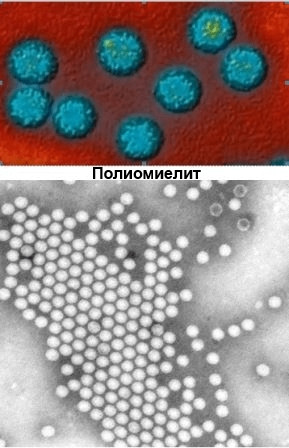 Как выглядит простуда под микроскопом. Смотреть фото Как выглядит простуда под микроскопом. Смотреть картинку Как выглядит простуда под микроскопом. Картинка про Как выглядит простуда под микроскопом. Фото Как выглядит простуда под микроскопом