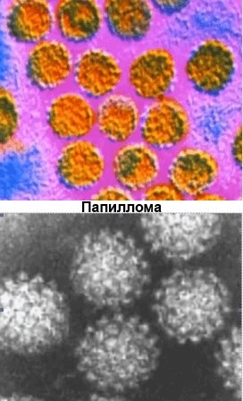 Как выглядит простуда под микроскопом. Смотреть фото Как выглядит простуда под микроскопом. Смотреть картинку Как выглядит простуда под микроскопом. Картинка про Как выглядит простуда под микроскопом. Фото Как выглядит простуда под микроскопом