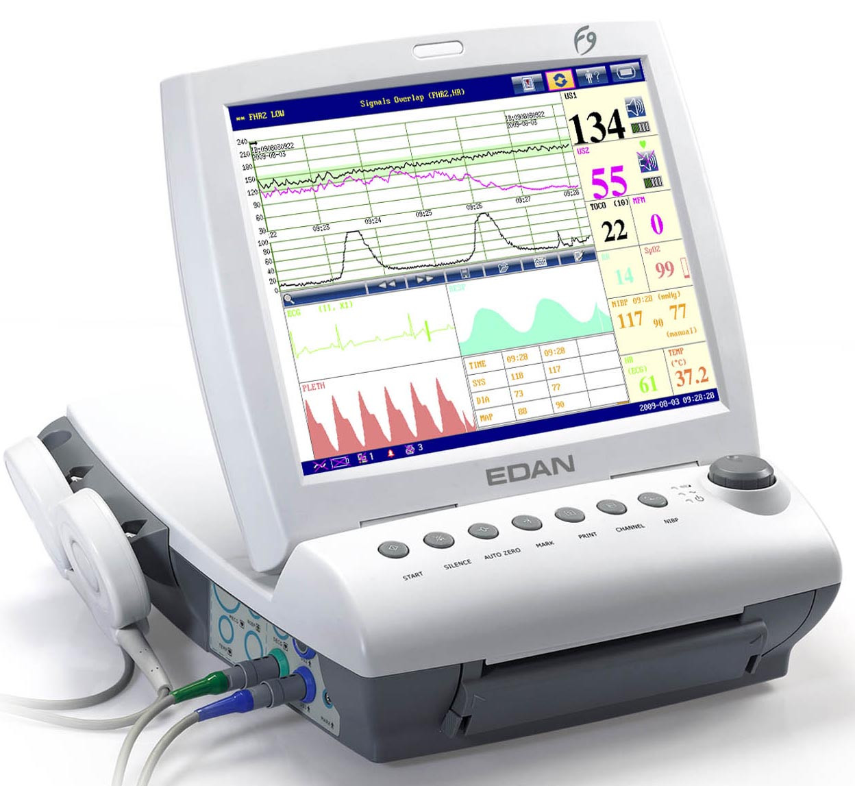 Фетальный монитор матери и плода F9 - фото 1 - id-p127272002