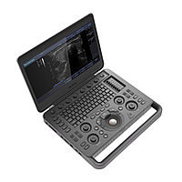 Ультрадыбыстық аппарат SonoScape S2N