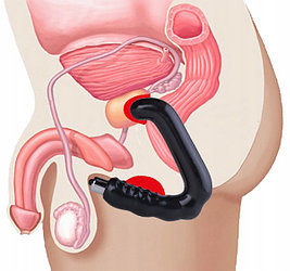 Массажеры простаты