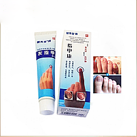 Мазь от ногтевого грибка