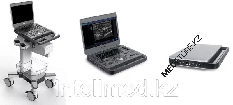Система для ультразвуковой диагностики SonoScape S2N ( PAD-платформа) - фото 3 - id-p92822424