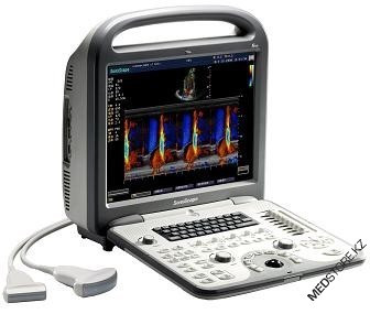 Система для ультразвуковой диагностики SonoScape S7 ( 3G-платформа) - фото 1 - id-p92822425
