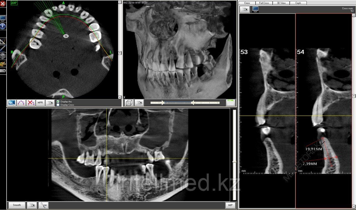 3D рентген аппарат Fona XPan 3D - фото 3 - id-p92826592