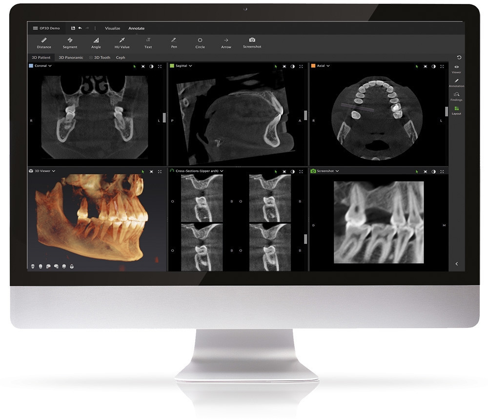 ТОМОГРАФ KAVO OP 3D область сканирования 9x ø14 с цефалостатом - фото 9 - id-p93530598