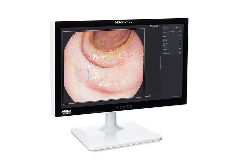 Интеллектуальная система для анализа эндоскопических изображений Pentax SAS-M10
