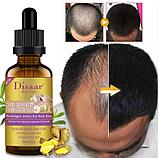 Disaar Hair Essence Oil - масло сыворотка для роста  волос от облысения., фото 4