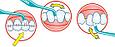 Монопучковая зубная щетка для брекетов имплантов, фото 6