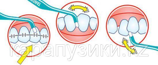 Монопучковая зубная щетка для брекетов имплантов - фото 6 - id-p80971657