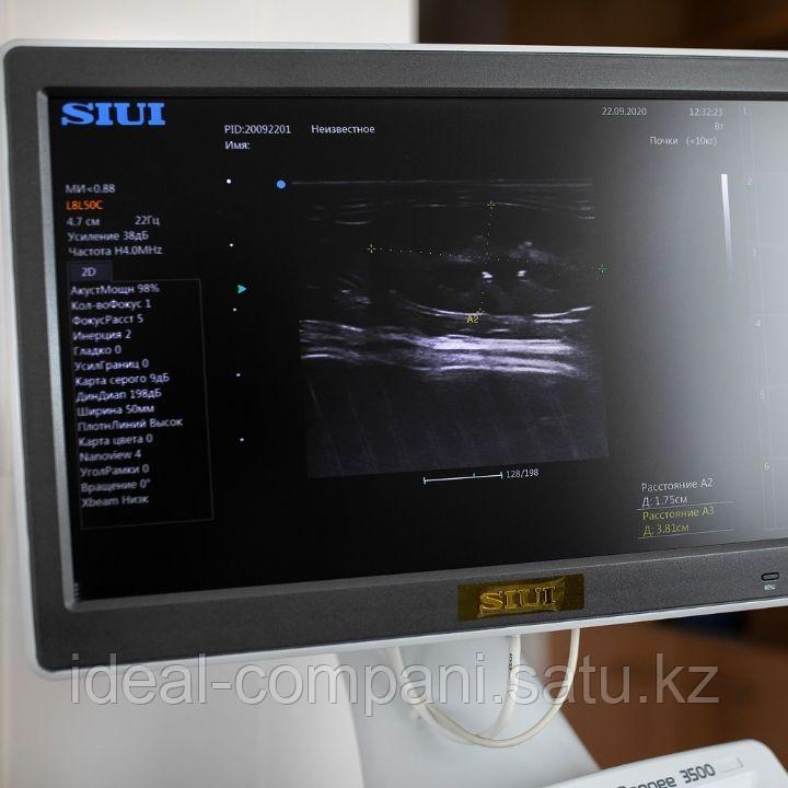 SIUI Apogee 3500 Стационарная цифровая ультразвуковая диагностическая система с цветным допплером - фото 7 - id-p95224153