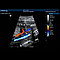 Mindray DC-30 Стационарная ультразвуковая диагностическая система с цветным доплером, фото 5