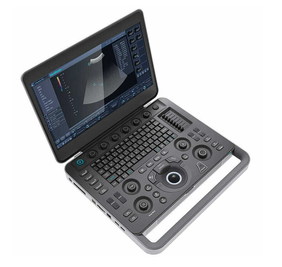 Портативный ультразвуковой сканер SonoScape S2N - фото 1 - id-p95255627