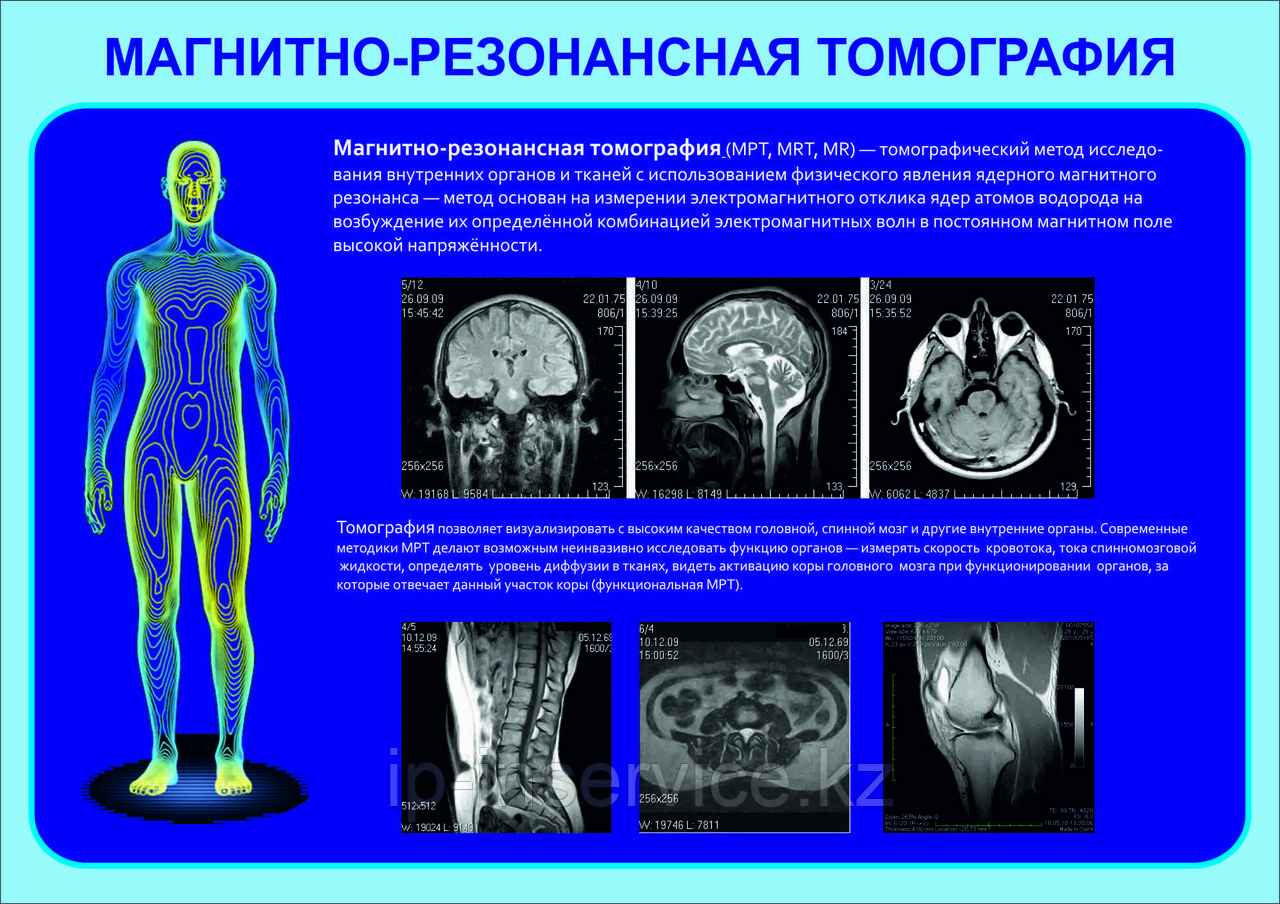 Плакаты ТОМОГРАФИЯ