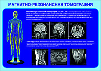 Плакаты Магнитно-резонансная томография