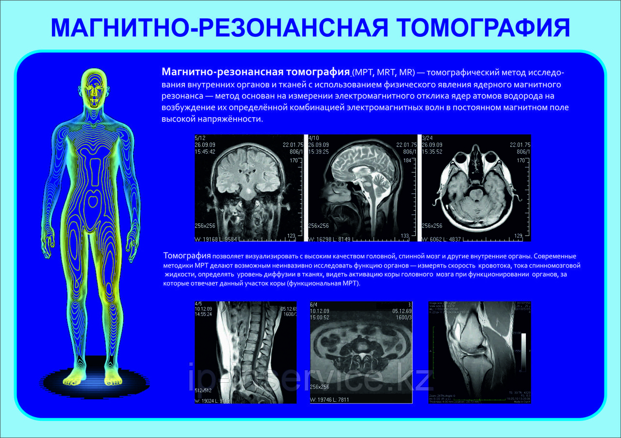 Плакаты Магнитно-резонансная томография - фото 1 - id-p4137726