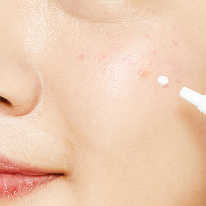 Лечебный локальный крем против акне COSRX AC Collection Ultimate Spot Cream, 30г., фото 2