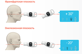 Настенный рентген дентальный VEX S300 W, фото 4