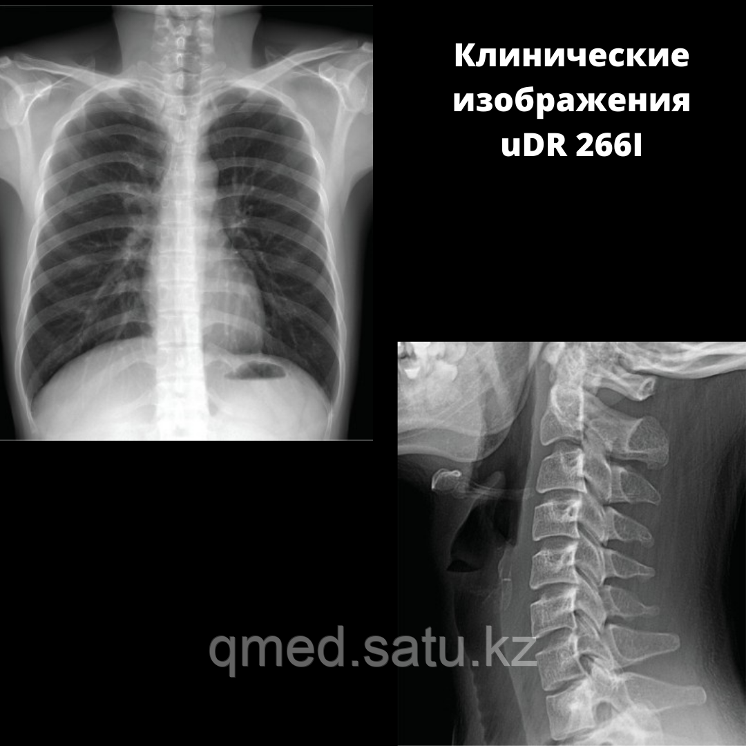 Цифровая рентгеновская система uDR 266i - фото 9 - id-p97067926