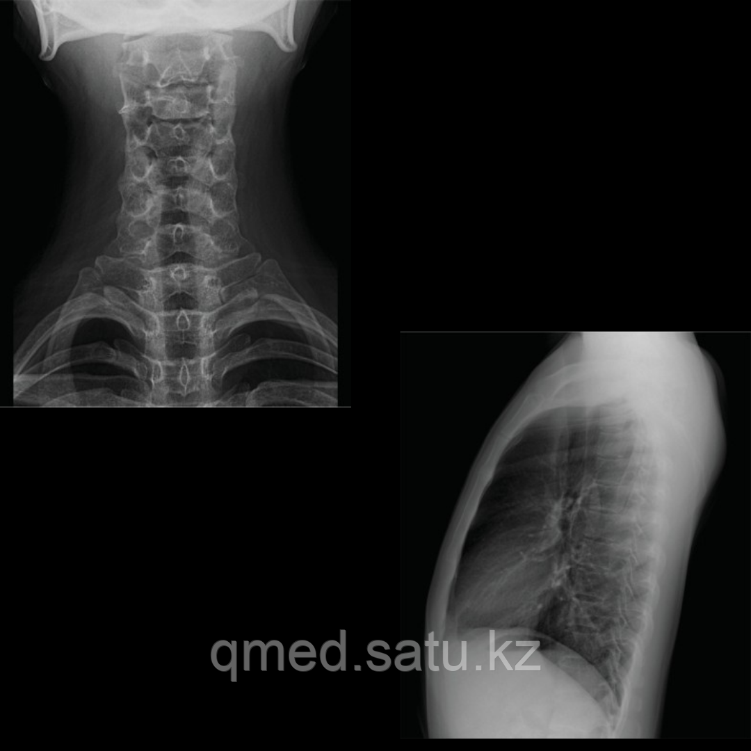 Цифровая рентгеновская система uDR 266i - фото 8 - id-p97067926