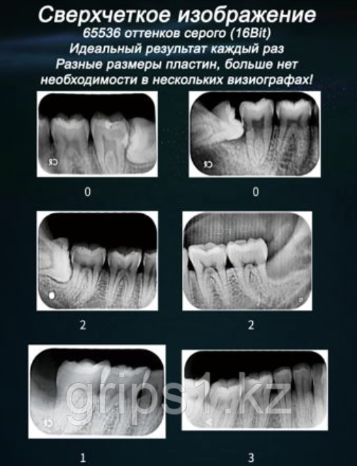Беспроводной визиограф для стоматологии. сканер фосфорных пластин | VRN EQ 600 (КИТАЙ)
