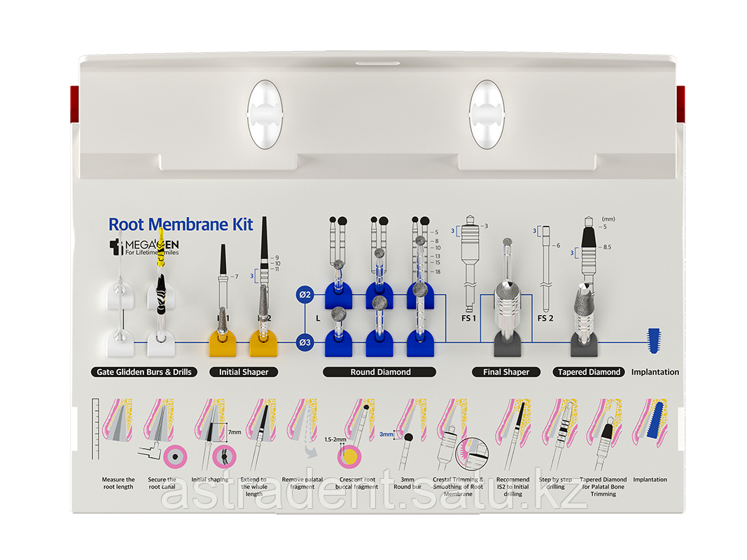 Набор для техники корневого щита/Root Membrane Kit/ MegaGen/